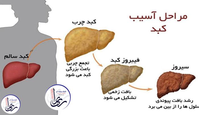 کبد چرب